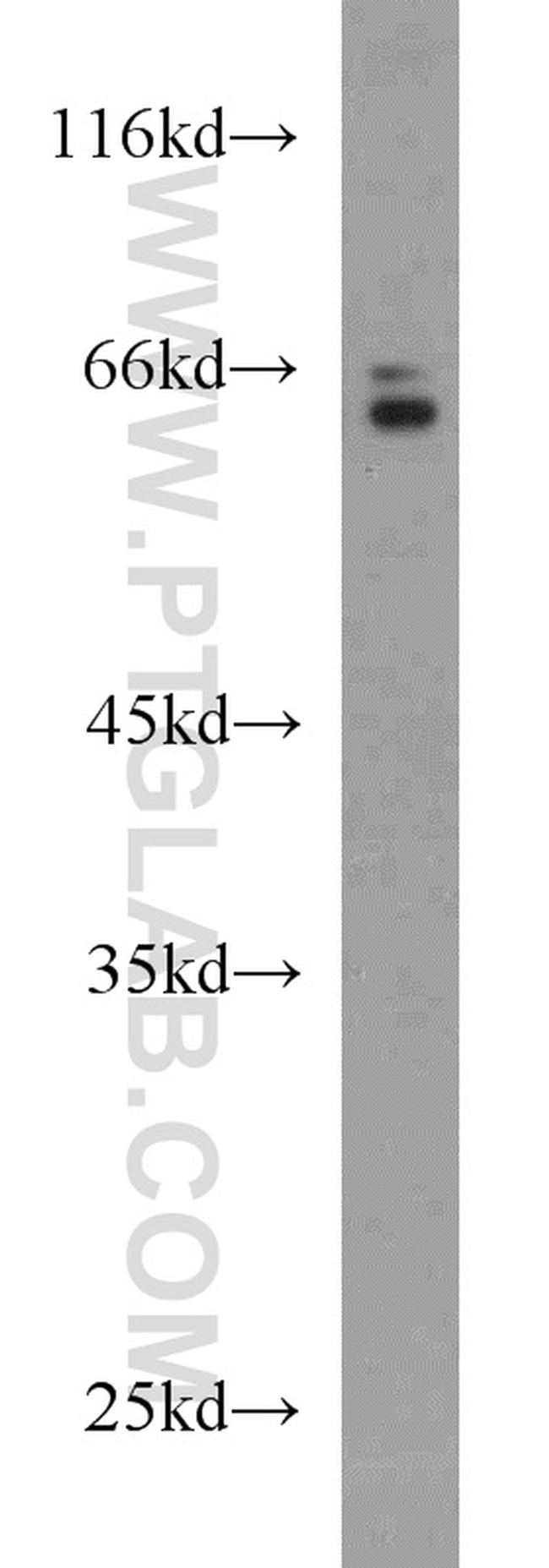 HAS3 Antibody in Western Blot (WB)