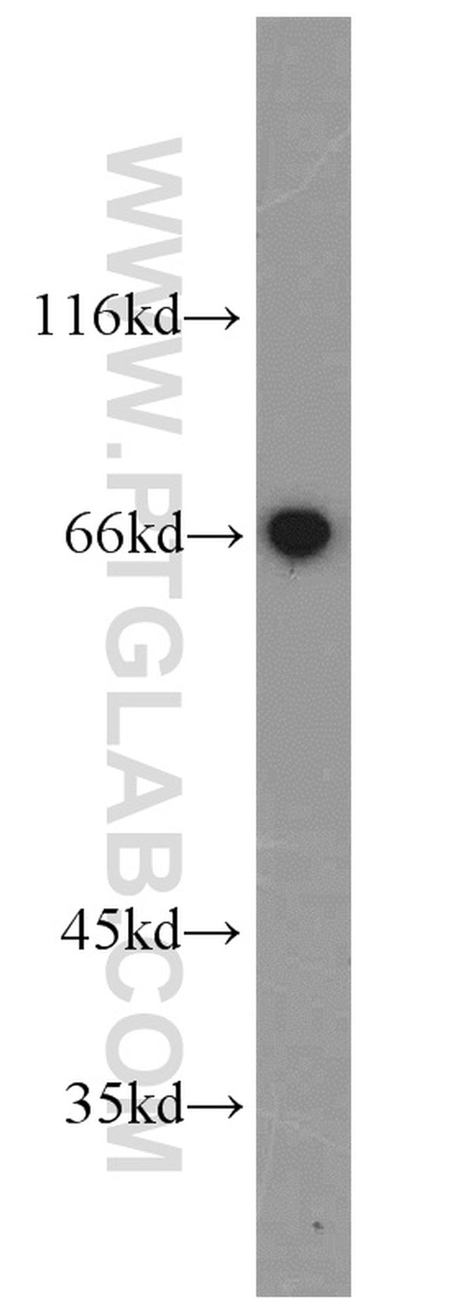 HAS3 Antibody in Western Blot (WB)