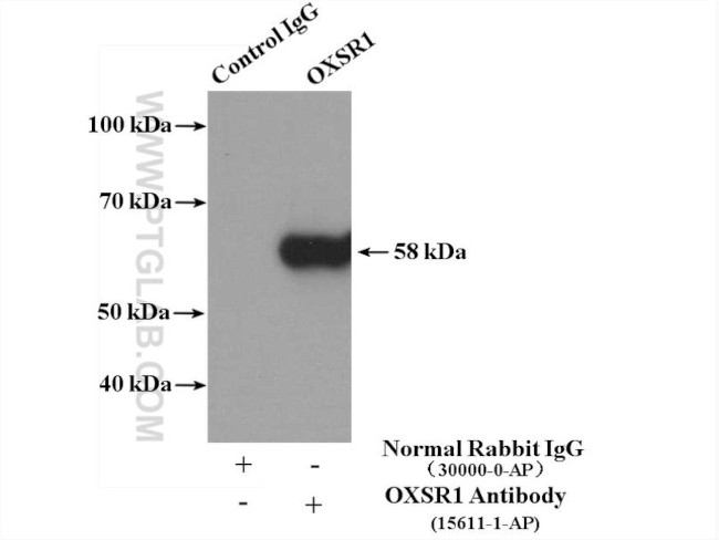 OXSR1 Antibody in Immunoprecipitation (IP)