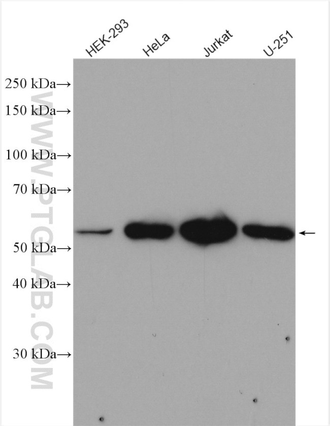 OXSR1 Antibody in Western Blot (WB)