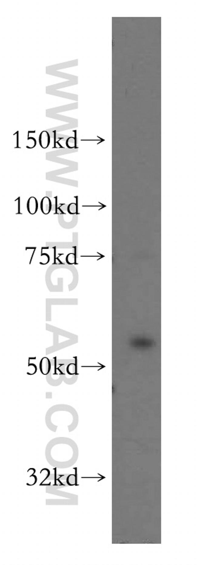 OXSR1 Antibody in Western Blot (WB)