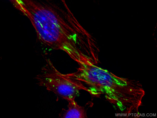 Fibronectin Antibody in Immunocytochemistry (ICC/IF)