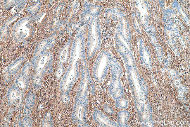 Fibronectin Antibody in Immunohistochemistry (Paraffin) (IHC (P))