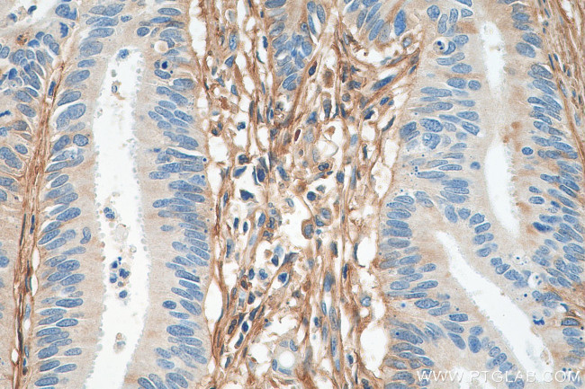 Fibronectin Antibody in Immunohistochemistry (Paraffin) (IHC (P))