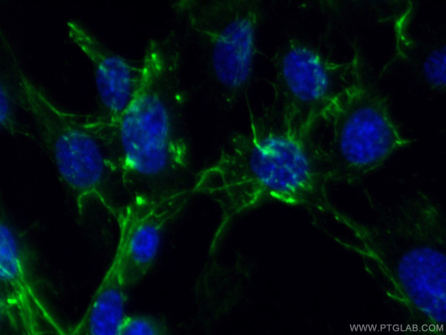 Fibronectin Antibody in Immunocytochemistry (ICC/IF)