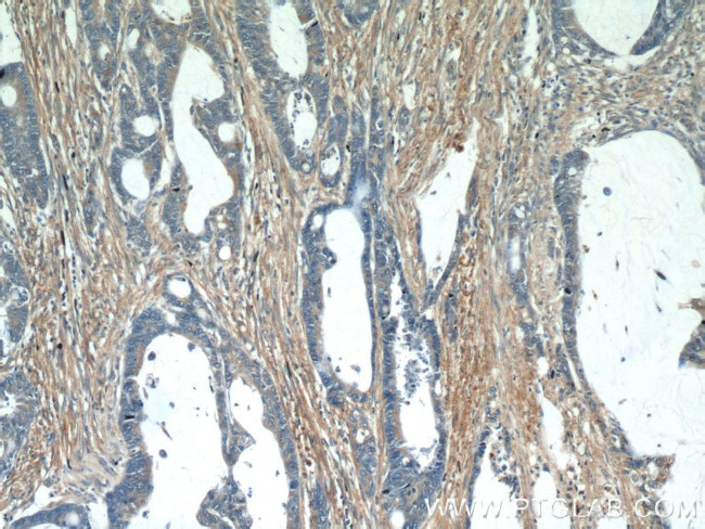 Fibronectin Antibody in Immunohistochemistry (Paraffin) (IHC (P))