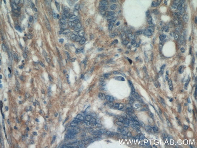 Fibronectin Antibody in Immunohistochemistry (Paraffin) (IHC (P))