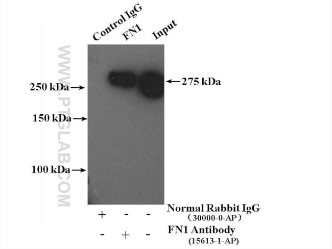 Fibronectin Antibody in Immunoprecipitation (IP)