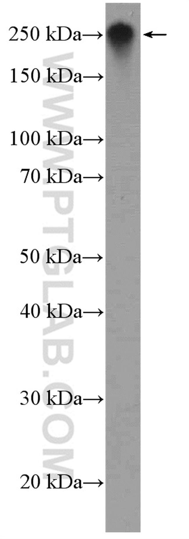 Fibronectin Antibody in Western Blot (WB)