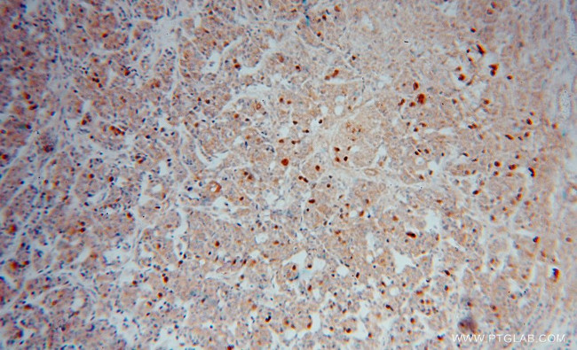 PRC1 Antibody in Immunohistochemistry (Paraffin) (IHC (P))