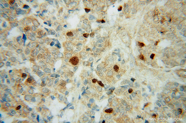 PRC1 Antibody in Immunohistochemistry (Paraffin) (IHC (P))