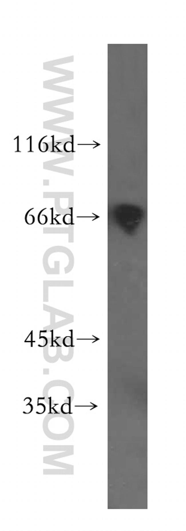 PRC1 Antibody in Western Blot (WB)