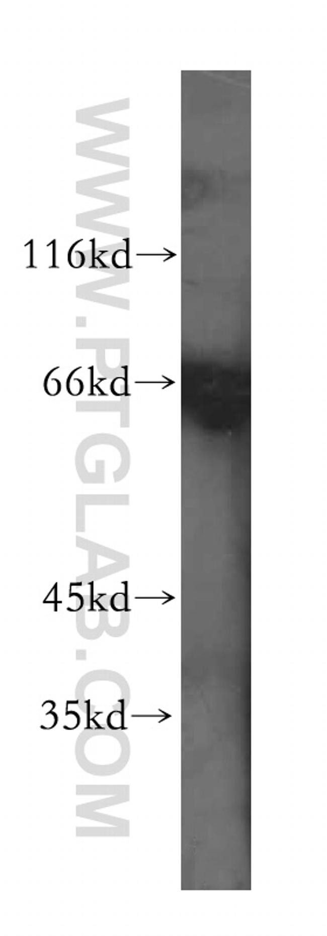 PRC1 Antibody in Western Blot (WB)