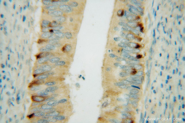 CBR3 Antibody in Immunohistochemistry (Paraffin) (IHC (P))