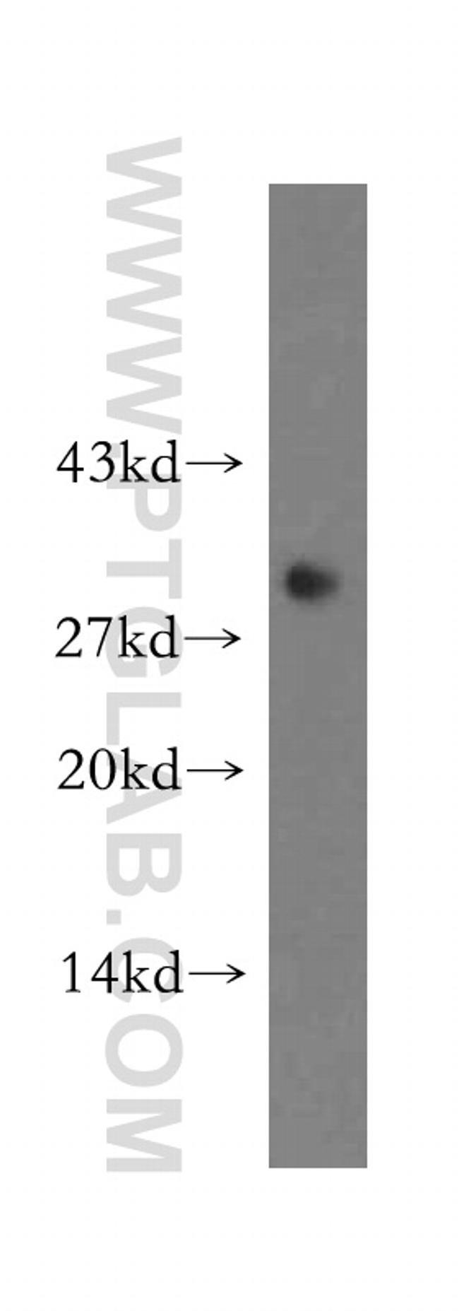 CBR3 Antibody in Western Blot (WB)