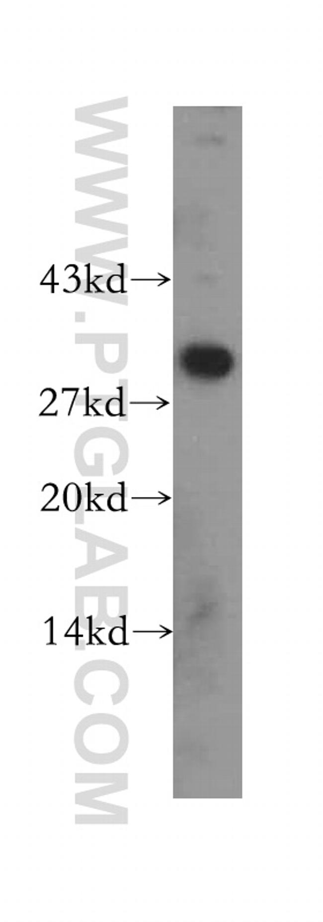 CBR3 Antibody in Western Blot (WB)