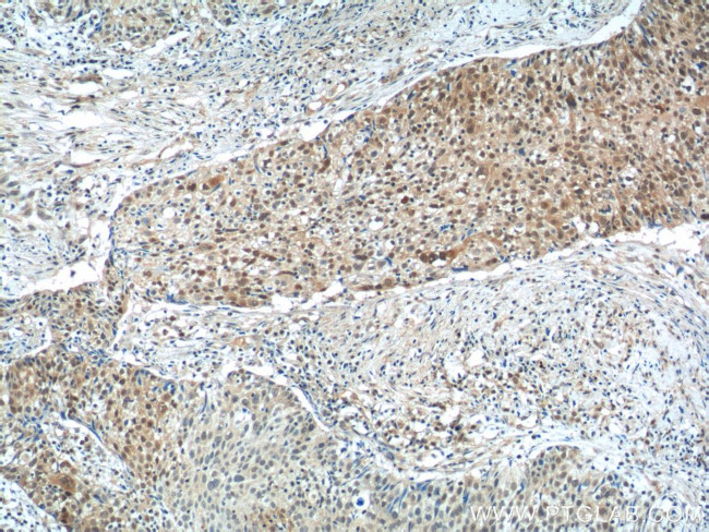 NSFL1C Antibody in Immunohistochemistry (Paraffin) (IHC (P))