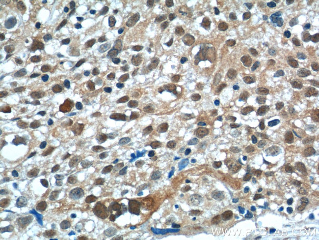 NSFL1C Antibody in Immunohistochemistry (Paraffin) (IHC (P))