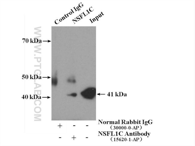 NSFL1C Antibody in Immunoprecipitation (IP)