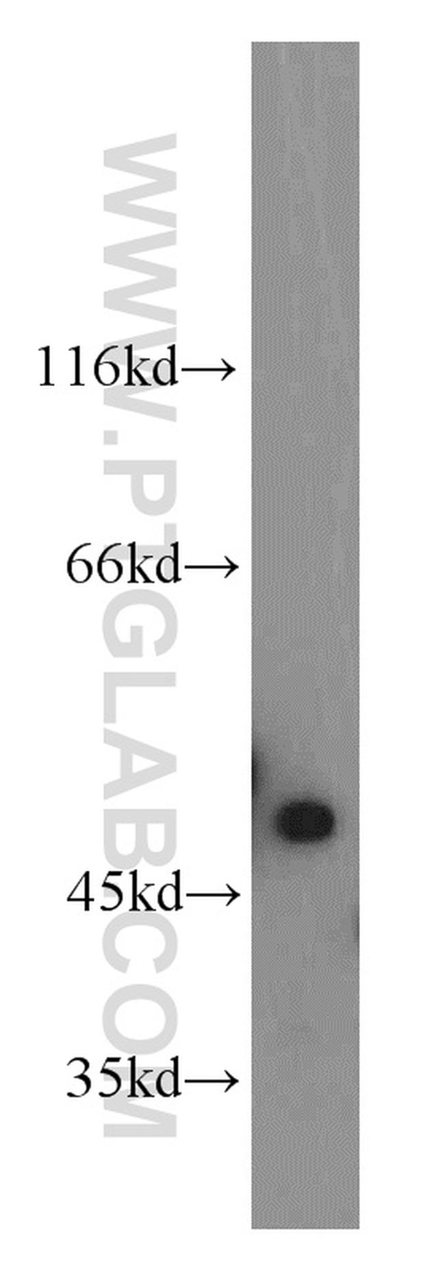 NSFL1C Antibody in Western Blot (WB)