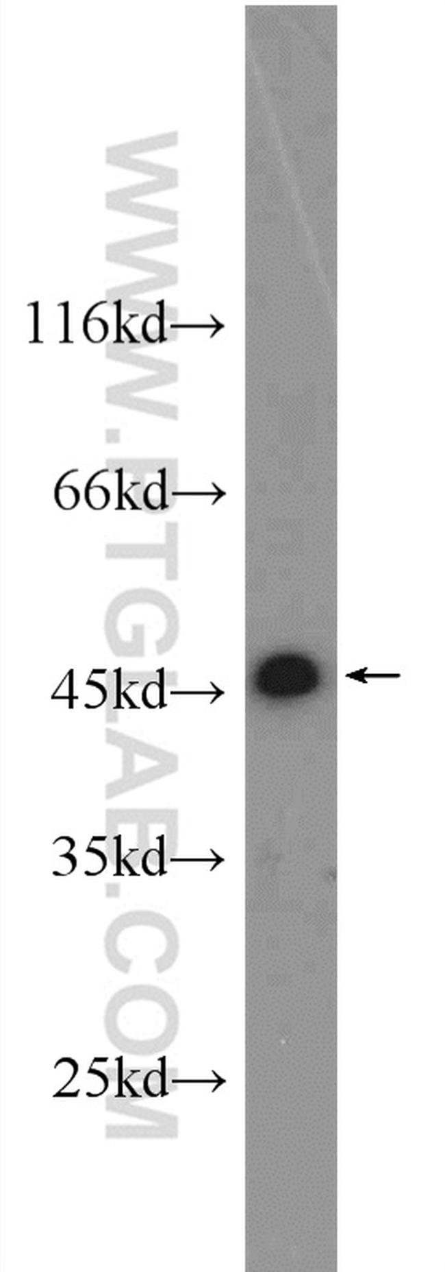 NSFL1C Antibody in Western Blot (WB)