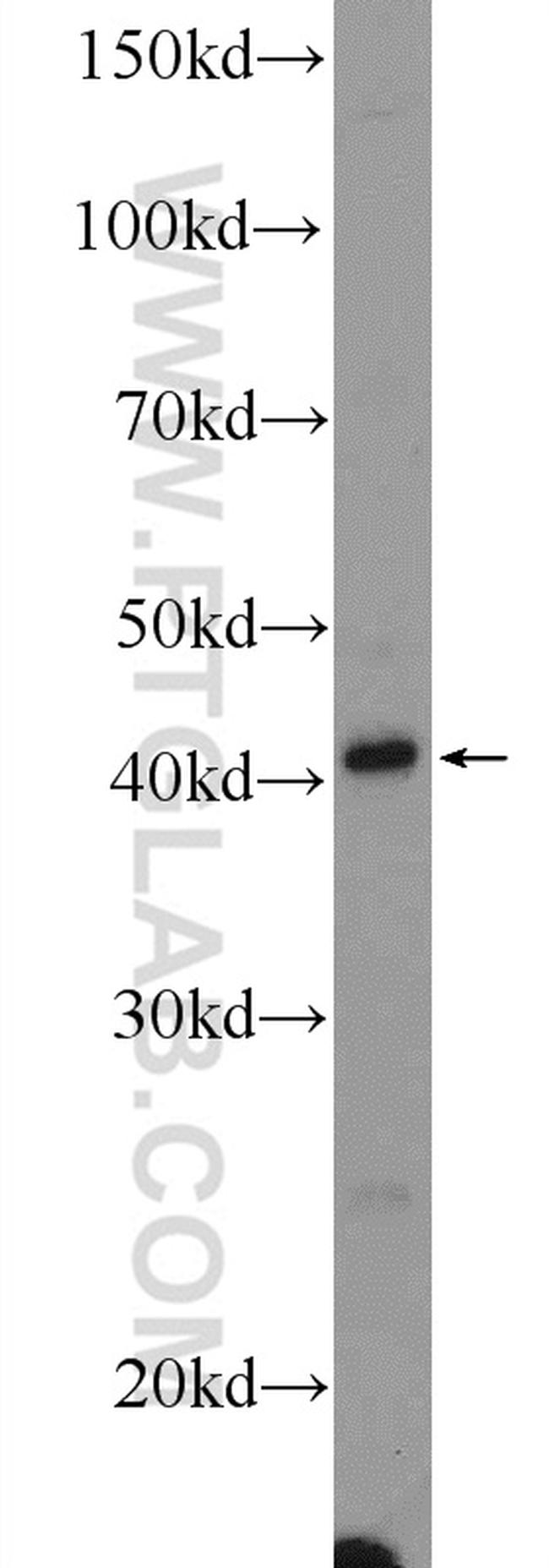 NSFL1C Antibody in Western Blot (WB)