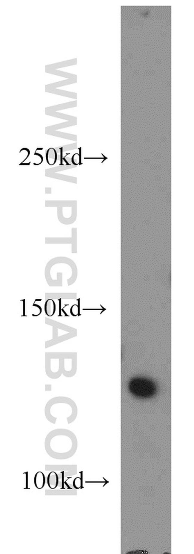 RNF40 Antibody in Western Blot (WB)