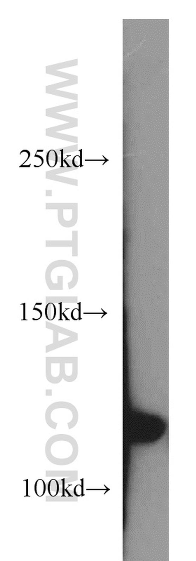 RNF40 Antibody in Western Blot (WB)