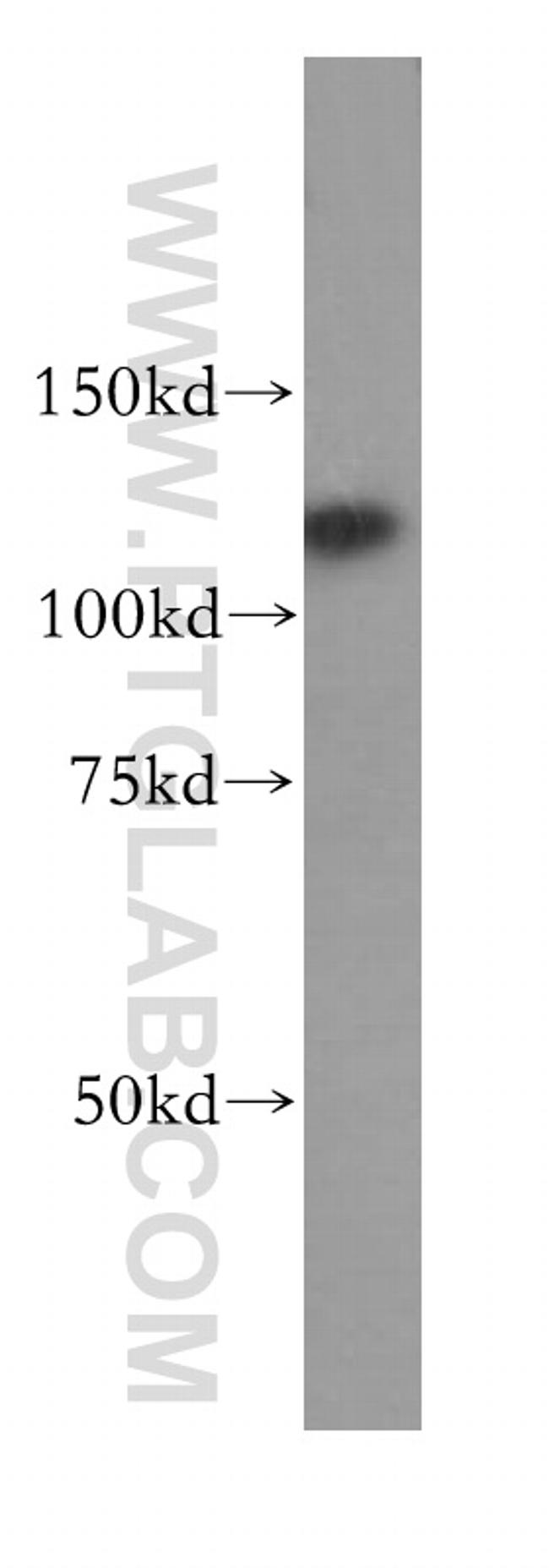 RNF40 Antibody in Western Blot (WB)