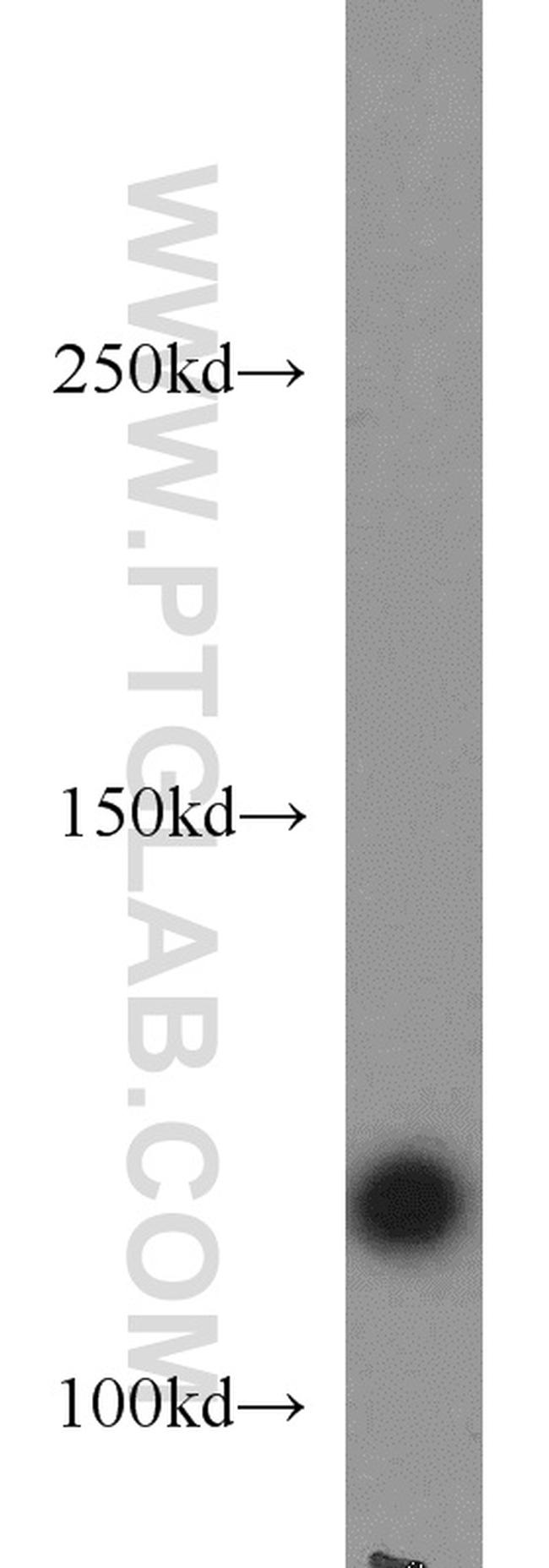 RNF40 Antibody in Western Blot (WB)