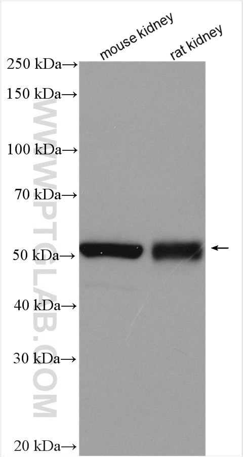 GABRD Antibody in Western Blot (WB)