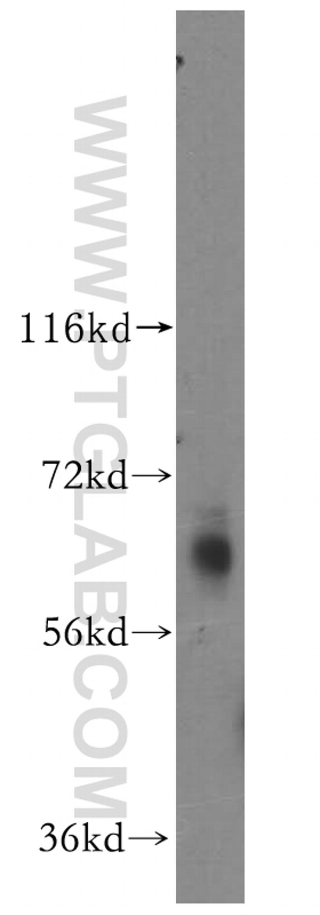 GABRD Antibody in Western Blot (WB)