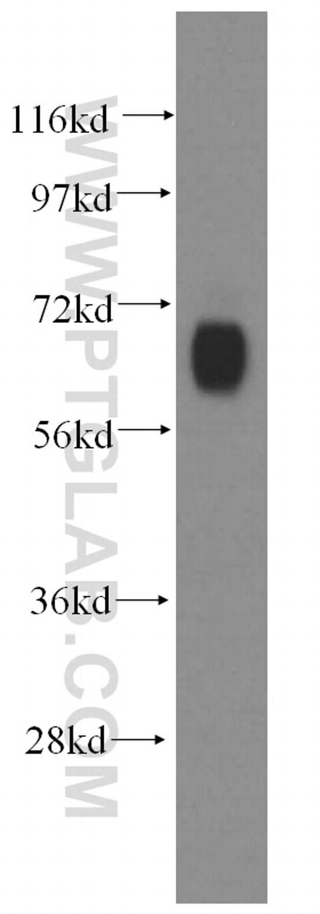 GABRD Antibody in Western Blot (WB)