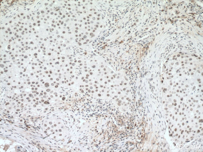 U2AF65 Antibody in Immunohistochemistry (Paraffin) (IHC (P))