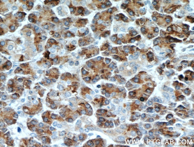 Carboxypeptidase A2 Antibody in Immunohistochemistry (Paraffin) (IHC (P))