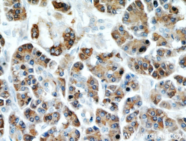 Carboxypeptidase A2 Antibody in Immunohistochemistry (Paraffin) (IHC (P))