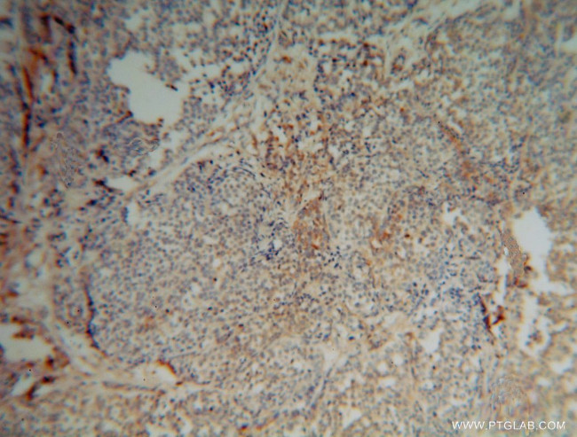 EXOSC5 Antibody in Immunohistochemistry (Paraffin) (IHC (P))