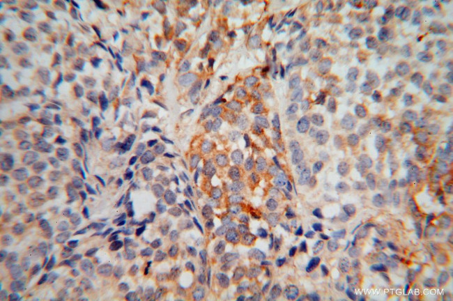 EXOSC5 Antibody in Immunohistochemistry (Paraffin) (IHC (P))