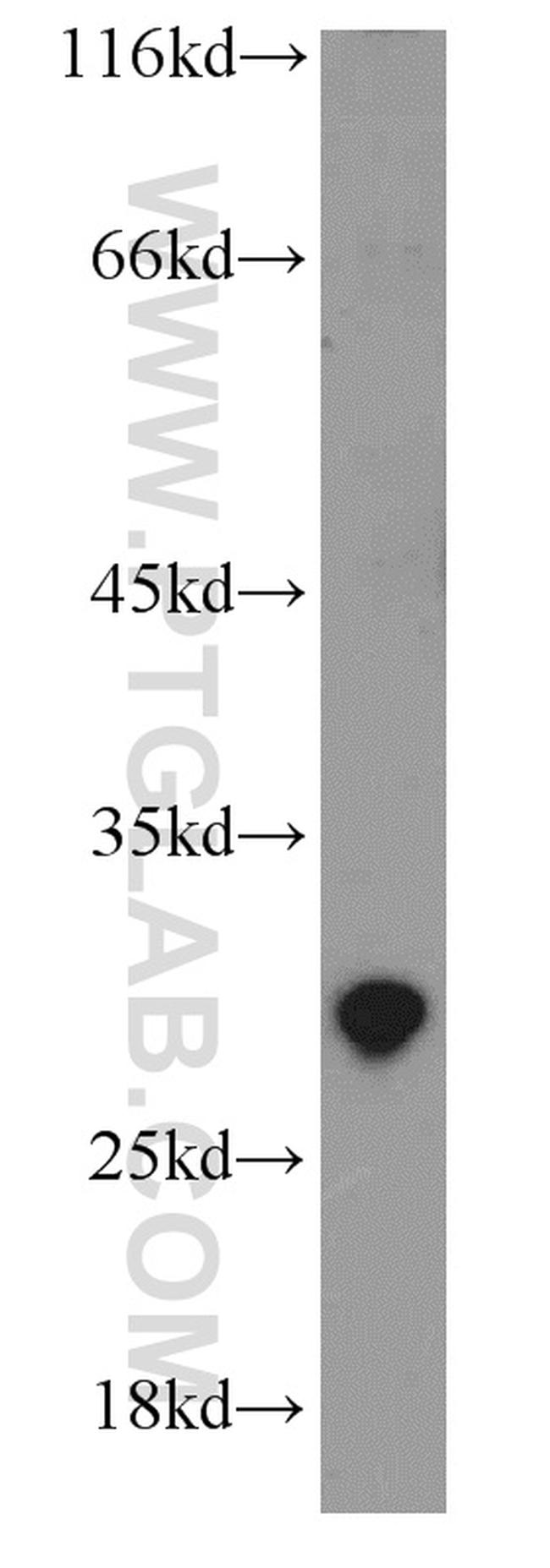 EXOSC5 Antibody in Western Blot (WB)