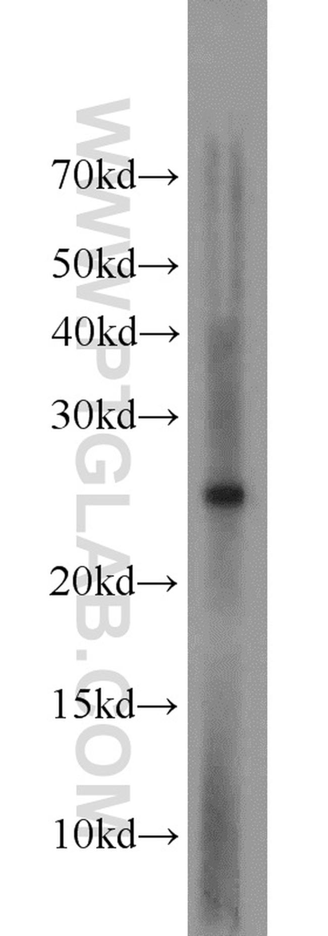 EXOSC5 Antibody in Western Blot (WB)