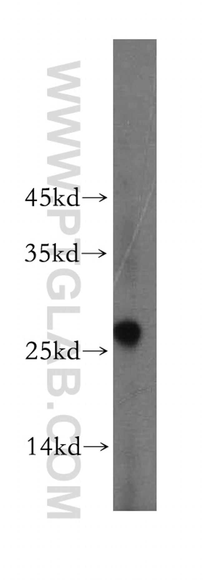 EXOSC5 Antibody in Western Blot (WB)