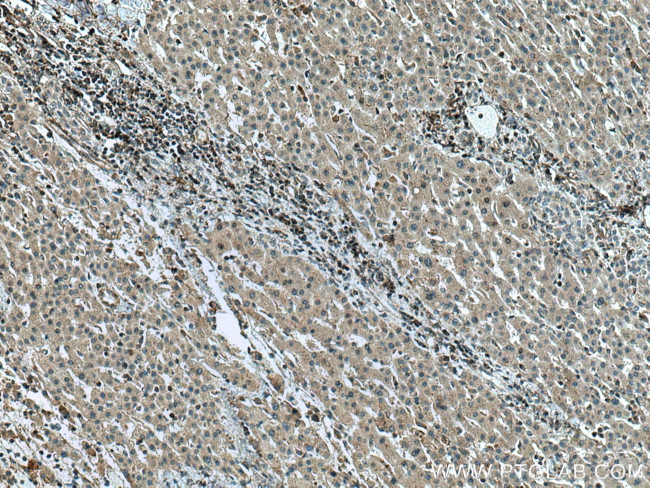 GCK Antibody in Immunohistochemistry (Paraffin) (IHC (P))