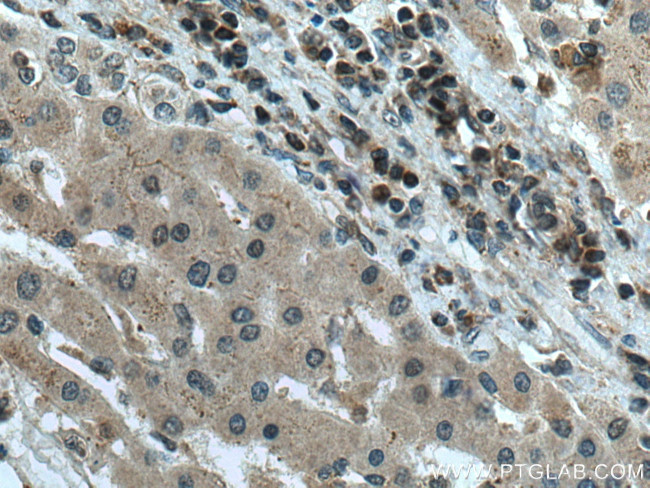 GCK Antibody in Immunohistochemistry (Paraffin) (IHC (P))