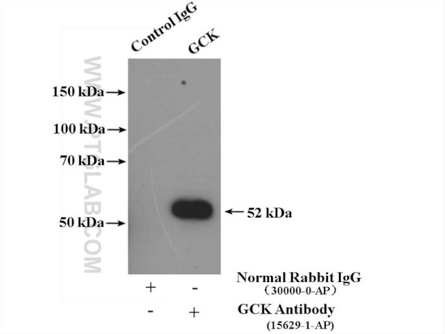 GCK Antibody in Immunoprecipitation (IP)