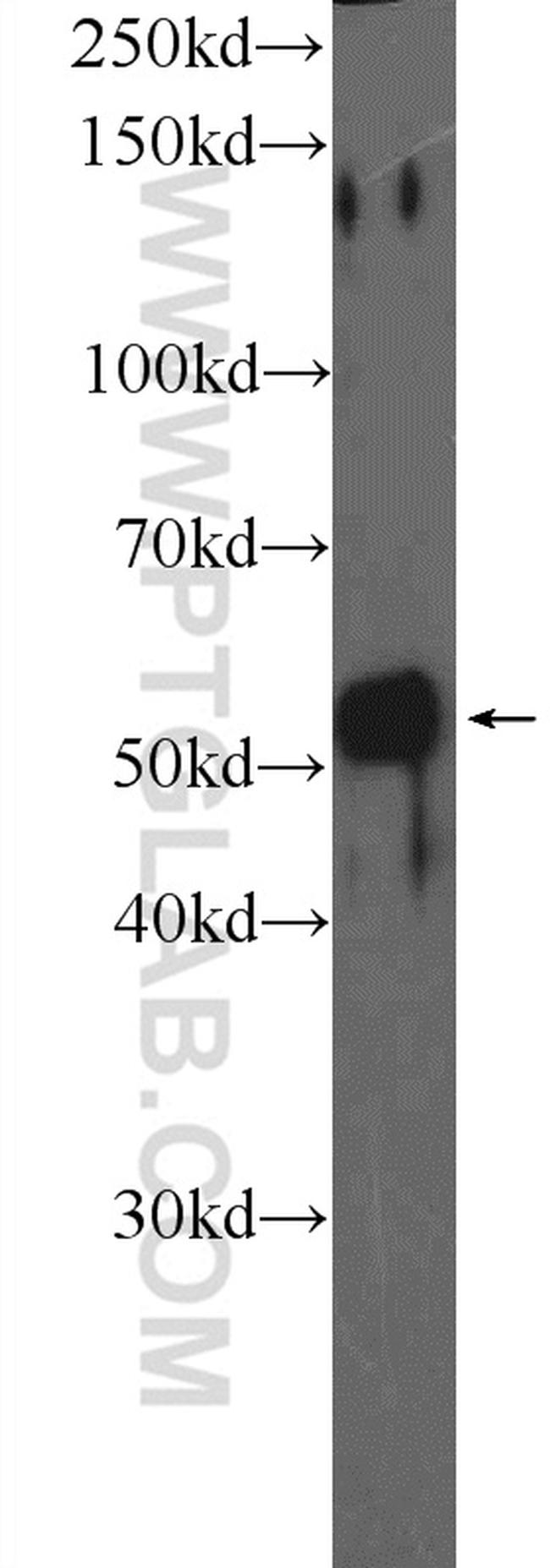 GCK Antibody in Western Blot (WB)