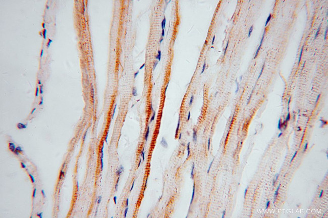 ACOT2 Antibody in Immunohistochemistry (Paraffin) (IHC (P))