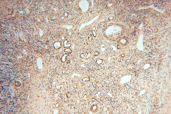 ACOT2 Antibody in Immunohistochemistry (Paraffin) (IHC (P))