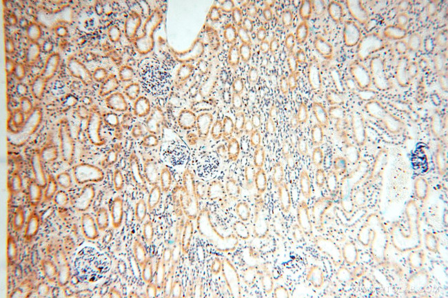 ACOT2 Antibody in Immunohistochemistry (Paraffin) (IHC (P))