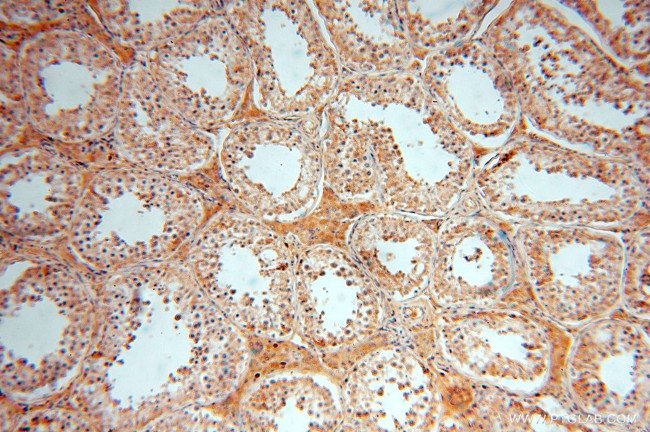 ACOT2 Antibody in Immunohistochemistry (Paraffin) (IHC (P))