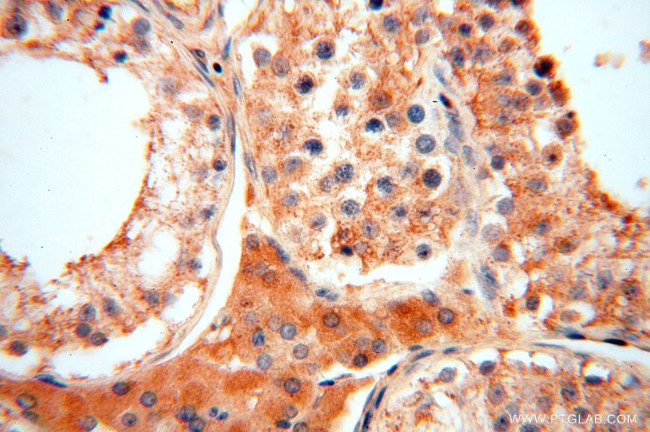 ACOT2 Antibody in Immunohistochemistry (Paraffin) (IHC (P))